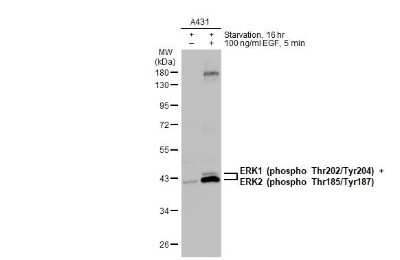 Western Blot: ERK1/ERK2 [p Thr185, p Tyr187] Antibody [NBP3-13137]